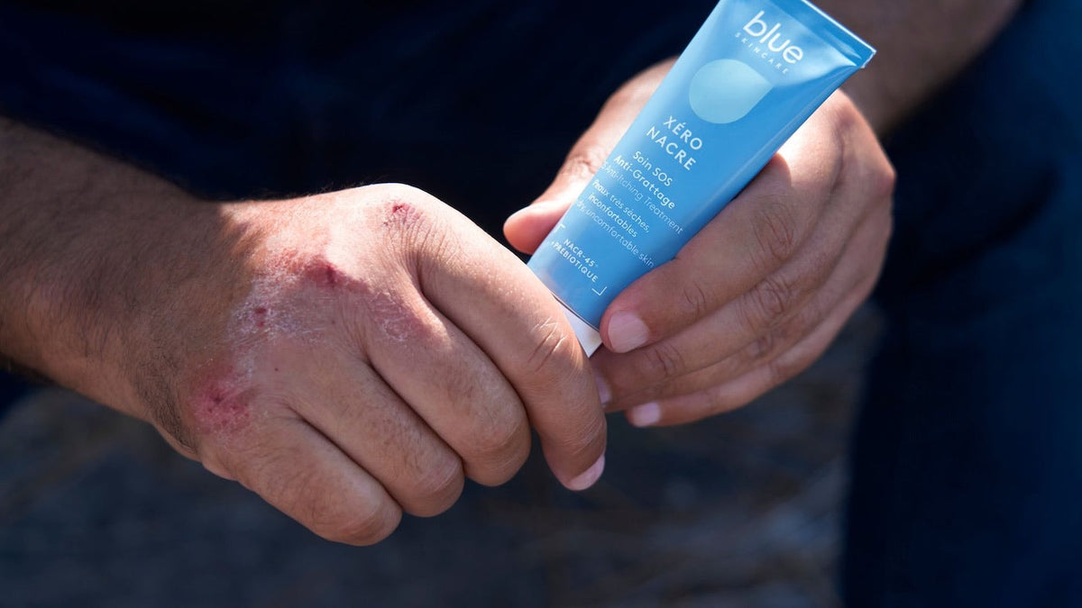 Comment bien appliquer un soin émollient ? Image