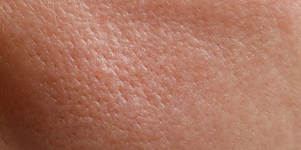 Rugosité du Corps et du Cuir Chevelu : Comprendre et Traiter cette Condition