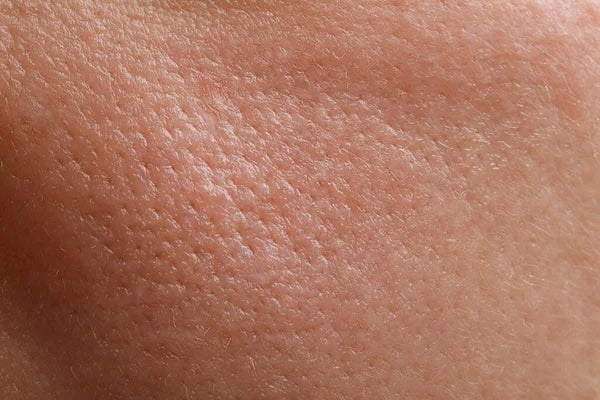 Rugosité du Corps et du Cuir Chevelu : Comprendre et Traiter cette Condition