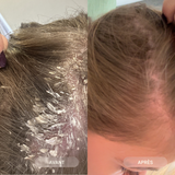 DANDRUFF &amp; SOOTHING ROUTINE